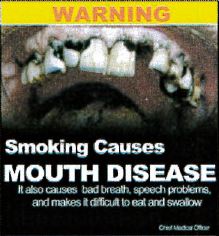 Jamaica 2013 Health Effect mouth - diseased teeth, gross (back)